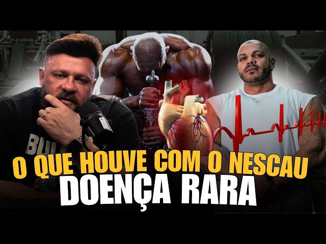 WELLINGTON NESCAU: DOENÇA RARA