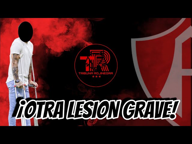 OTRA LESION GRAVE EN ATLAS | ARBITRAJE AFECTA AL ROJINEGRO | EDDY RODRIGUEZ TR EN VIVO