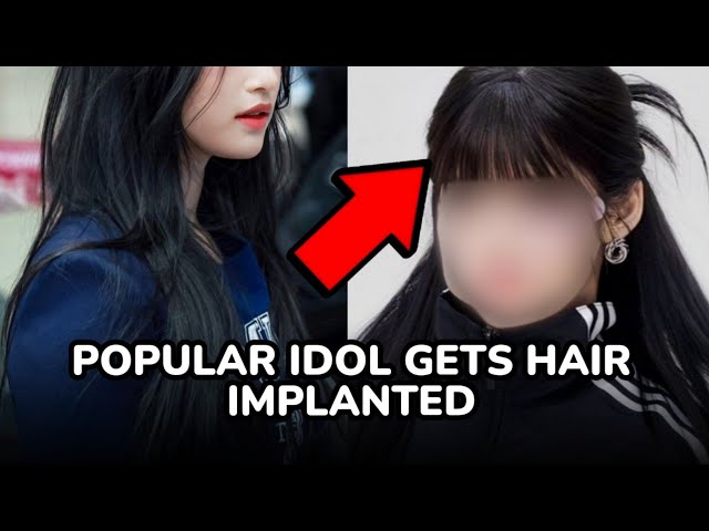 POPULAR IDOL OPENLY REVEALS SHE GOT A HAIR TRANSPLANT