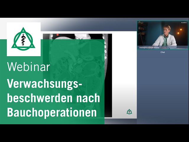 Verwachsungsbeschwerden nach Bauchoperationen Webinar der Asklepios Klinik Altona | Asklepios