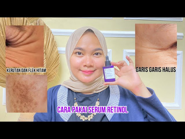 Review retinol serum some by mi | Cara pakai serum retinol untuk pemula