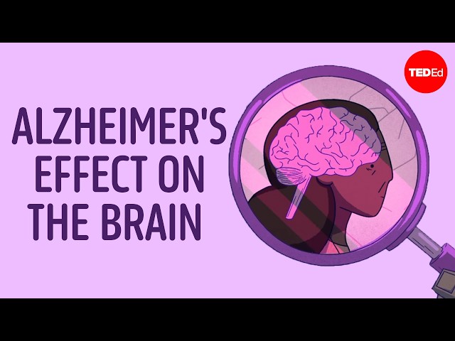 Why is Alzheimer’s disease so difficult to treat? - Krishna Sudhir