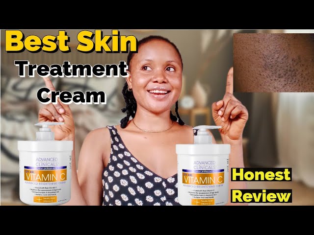 How to Treat your Skin with ADVANCED CLINICALS VITAMIN C/Body Lotion REVIEW