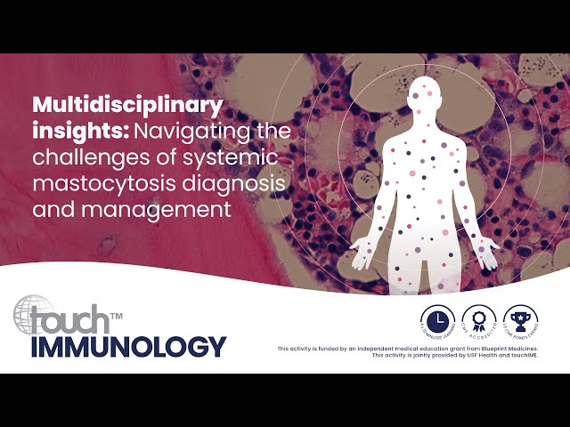 Multidisciplinary insights:Navigating the challenges of systemic mastocytosis diagnosis & management