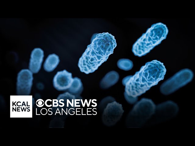 Orange County sends out health warning after detecting Legionnaire's Disease