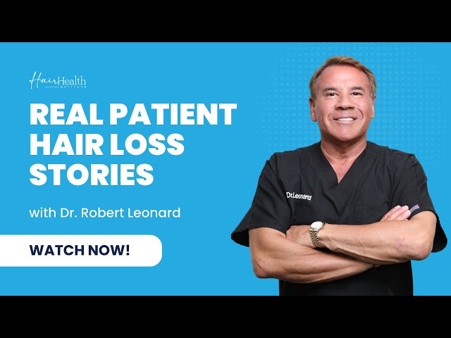 Real Patient Hair Loss Stories from Dr. Robert Leonard