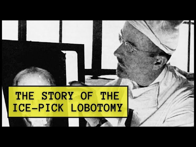 Walter Freeman, and the Story of the Ice-Pick Lobotomy