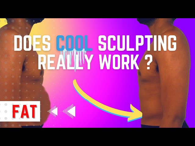 Does Cool Sculpting Really Work? Yes or No | Michael Ferrera