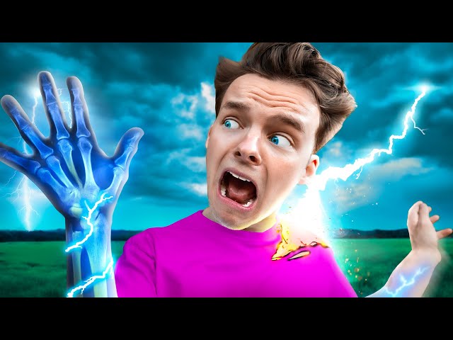 I GOT STRUCK BY LIGHTNING! (THIS IS NOT A JOKE)