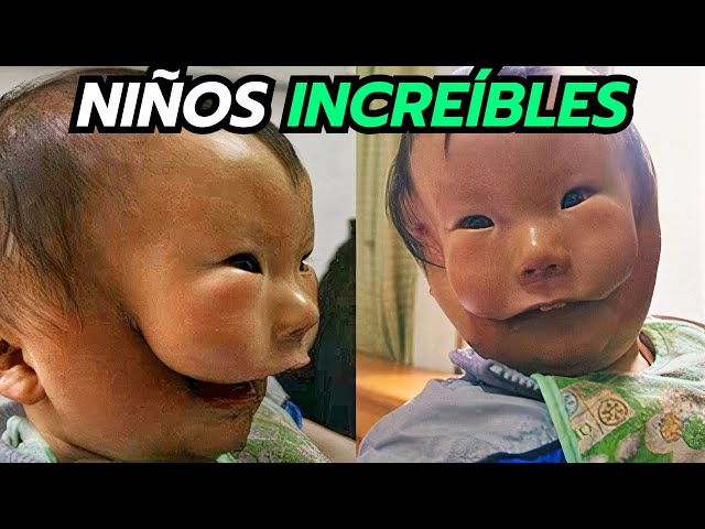 20 Niños Inusuales Más Inspiradores Del Mundo - Increíble