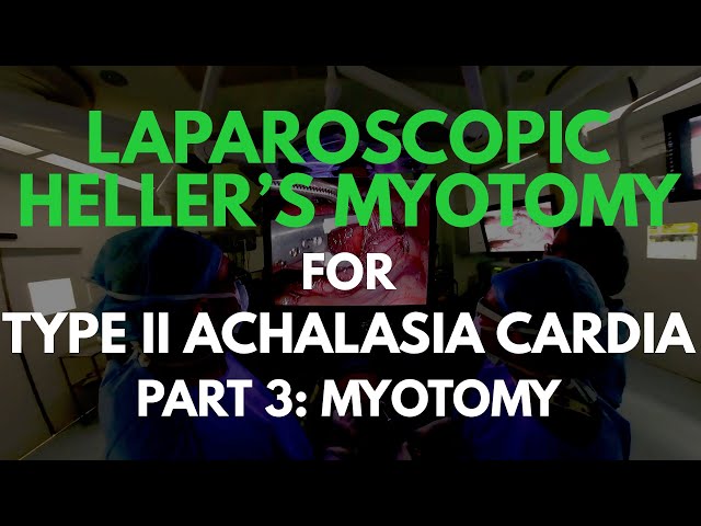 Laparoscopic Heller's Myotomy in VR