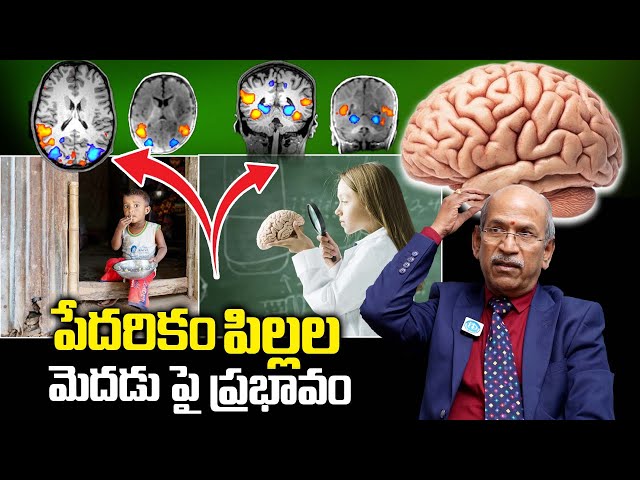 Change Your Life To Change Your Brain | Boost Kids Brain Power, Memory | DR.Ranganadham Neurosurgeon