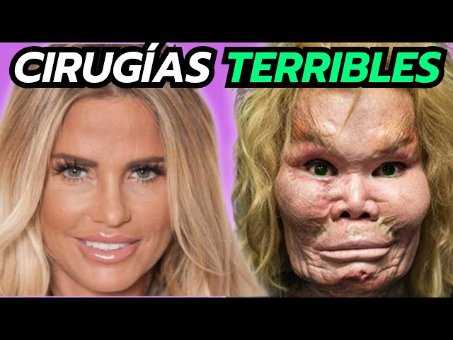 20 Cirugías Que Salieron Terriblemente Mal De Celebridades y Famosos