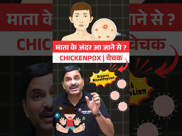 Chickenpox 🦠 Causes, Symptoms, Treatment & Prevention ‼️ #shorttrick #facts #health #fyp #shorts