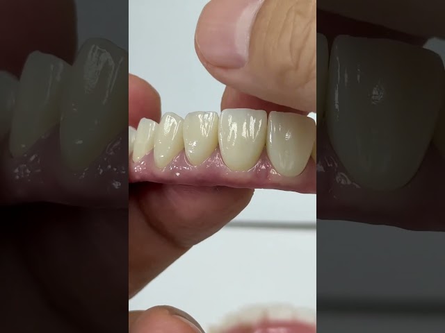 No composite not acrylics!