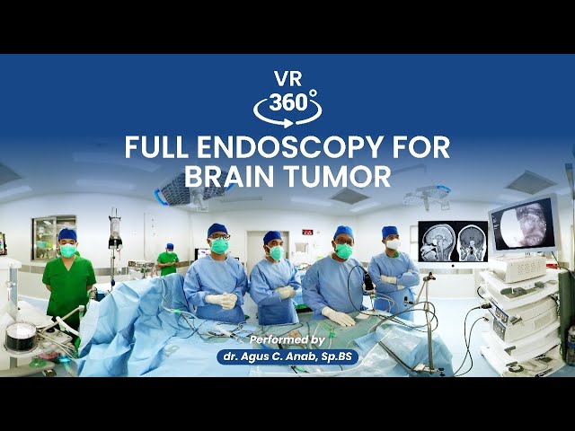 VR 360⁰ KORTEX Full Endoscopic for Pituitary Tumor (Hypofise) Performed by dr. Agus ACA