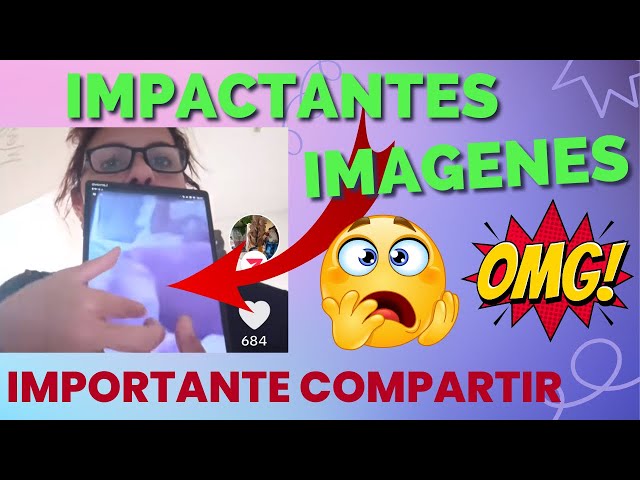 IMPACTANTES IMÁGENES,CASO DEREK ROSA #noticias #video #viral